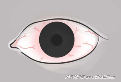 花一分钟观察一下眼睛，千万不能轻忽了这10个症状！