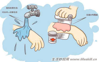 如何处理烫伤后起的水泡？